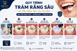 Quy trình Trám răng sâu tại Nha Khoa Kim Lux Sài Gòn - Đà Lạt