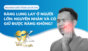 Răng lung lay ở người lớn: Nguyên nhân và có giữ được răng không?