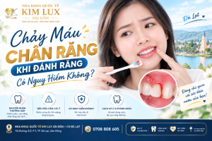 chay-mau-chan-rang-khi-danh-rang-kimluxdental