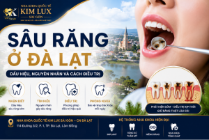 Sâu răng ở Đà Lạt dấu hiệu nguyên nhân và cách điều trị