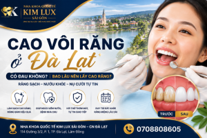 Cạo vôi răng ở Đà Lạt