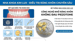 Nhổ răng khôn ở Đà Lạt