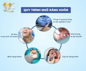 Quy trình nhổ răng khôn