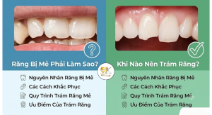 Răng bị mẻ phải làm sao? Khi nào nên trám răng?