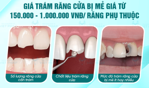 gia tram rang me