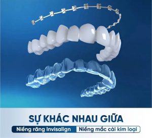 Su khac nhau giua mac cai kim loai va mac cai trong suot