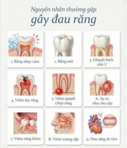 Những nguyên nhân gây đau răng
