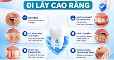 Dấu hiệu cho thấy nên đi lấy cao răng