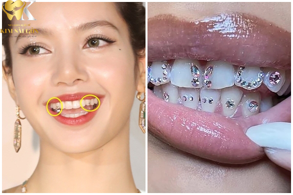 kim sai gon dental dinh da