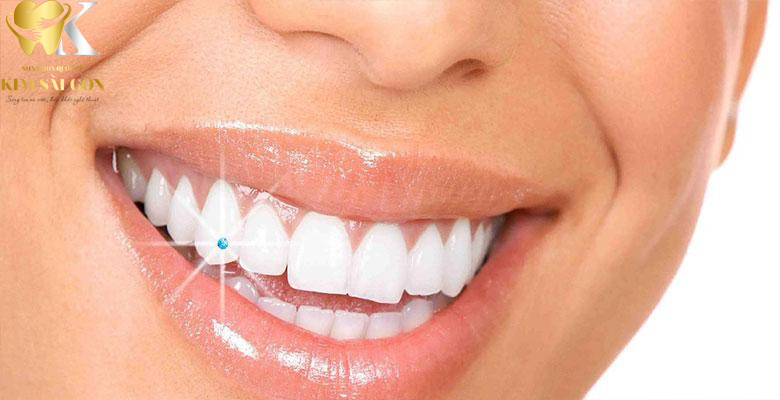 kim sai gon dental dinh da2