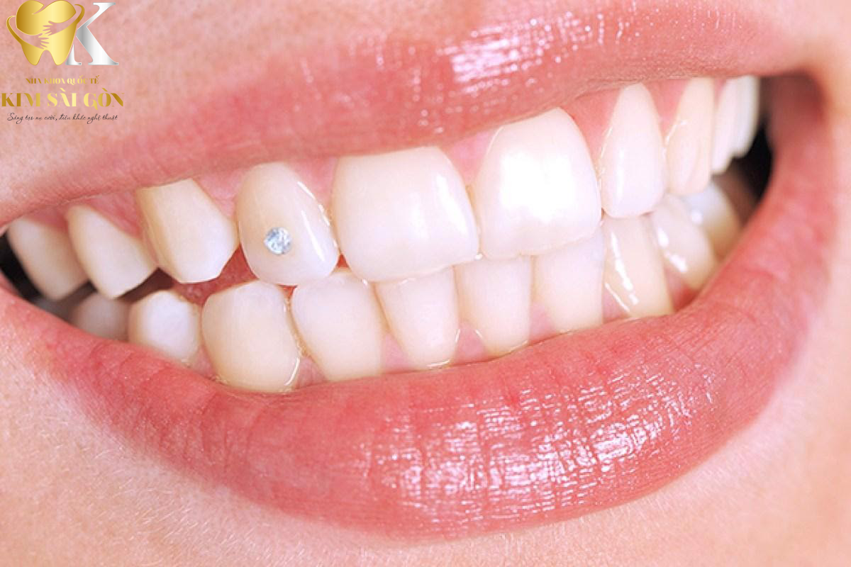 kim sai gon dental dinh da3