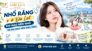 Nhổ răng ở Đà Lạt: Khi nào nên nhổ và khi nào nên bảo tồn?