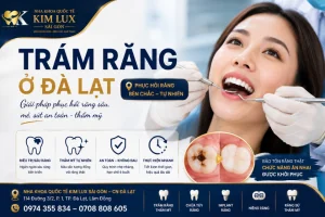 Trám răng ở Đà Lạt